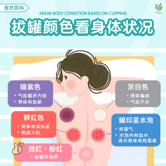 拔罐颜色看身体状况 • Know Body Condition Based On Cupping
